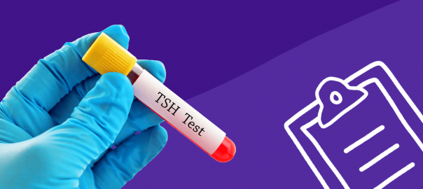 What Is A Tsh Test And What Do Your Results Mean