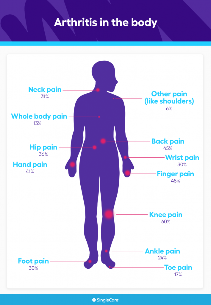 Arthritis survey and updated statistics | SingleCare