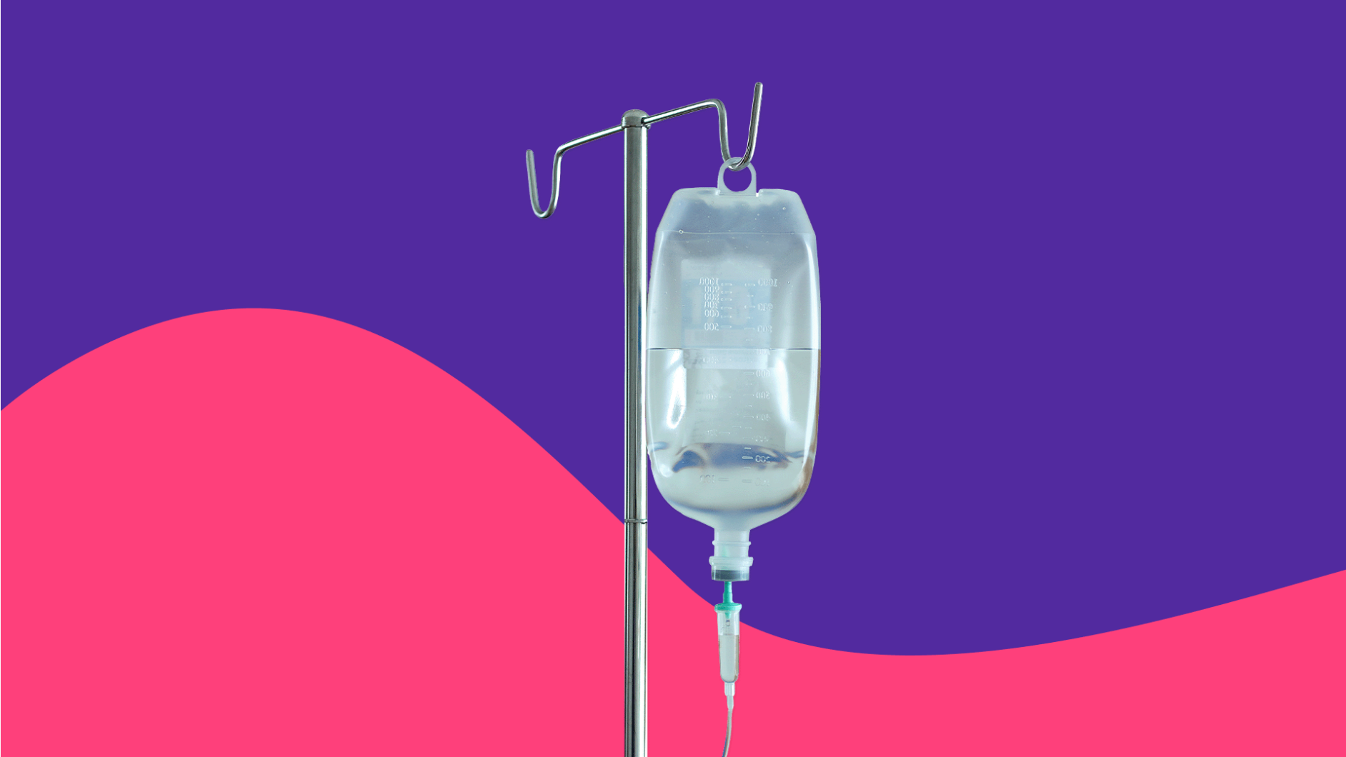 An IV bag: Stelara infusion: What to expect